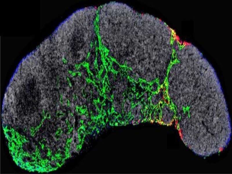 Descubren Mecanismo Que Causa La Met Stasis Del Melanoma Y C Mo