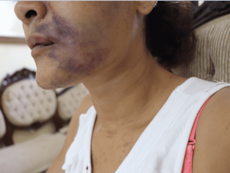 Mujeres golpeadas ya no podrán otorgar perdón a sus agresores en Yucatán