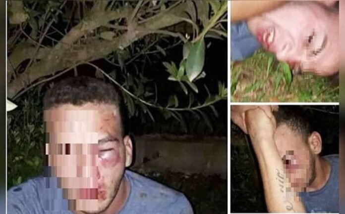 sujeto-rostro-desfigurado-golpiza-acoso_58_0_1084_675